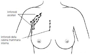 Screening oncologici: “Esclusi, in violazione di legge, le donne dai 40-49 anni e 70-75 per il cancro al seno, e i cittadini da 45 a 49 anni e 70-75 per il colon”