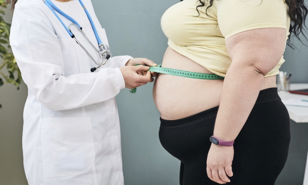 Obesity Day 2024: iniziativa al Perrino di Brindisi